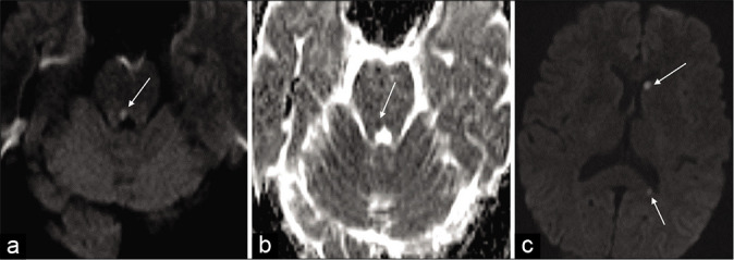 Figure 7: