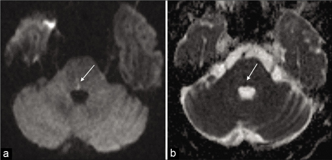 Figure 6: