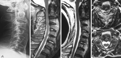 Fig. 3