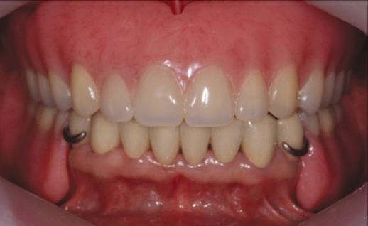 Fig. 7