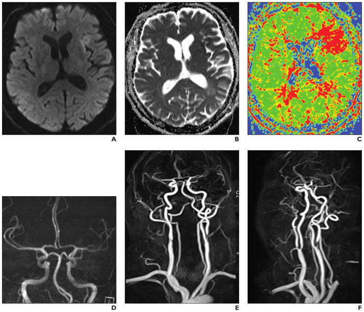 Fig. 10