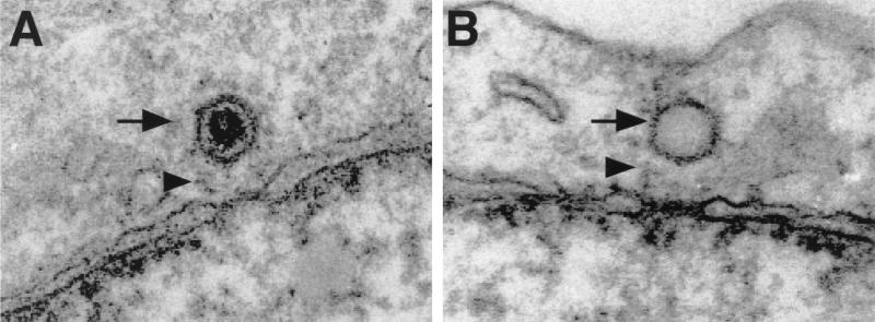 FIG. 1