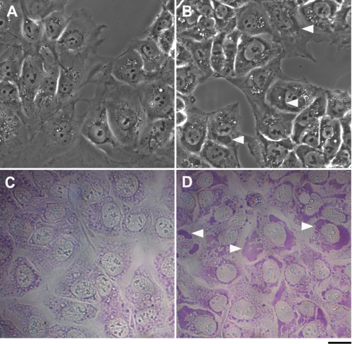 FIGURE 11.