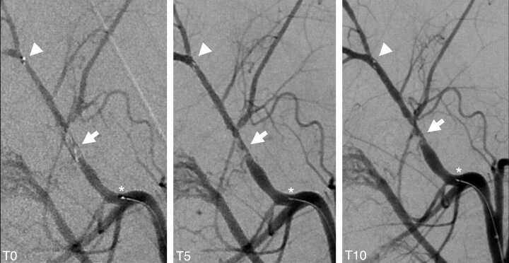 Fig 3.