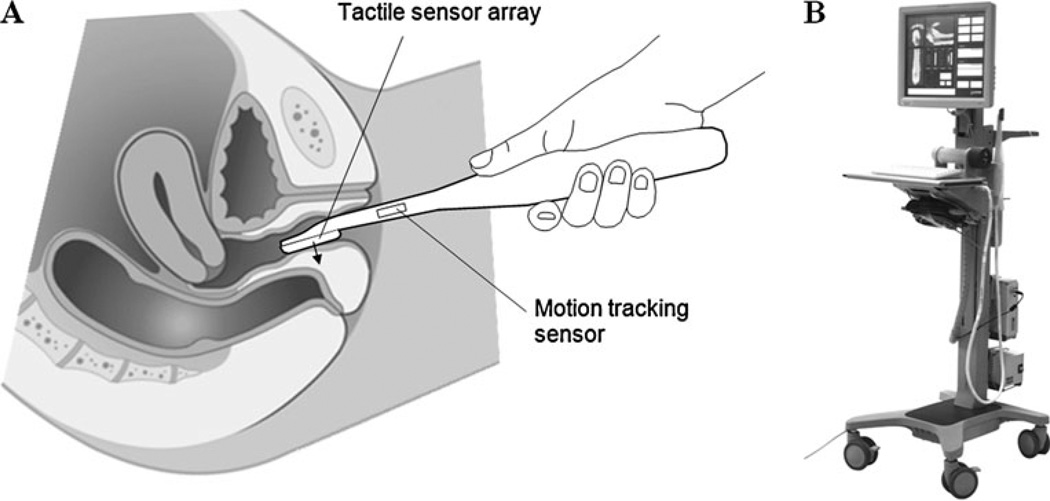 Fig. 1