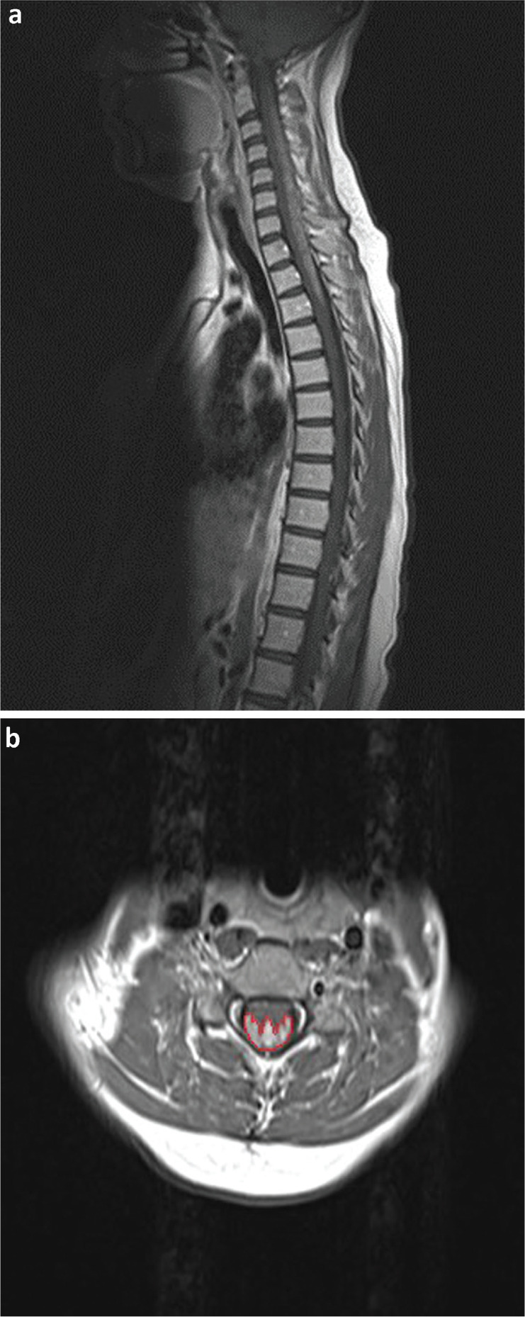 Fig 1.