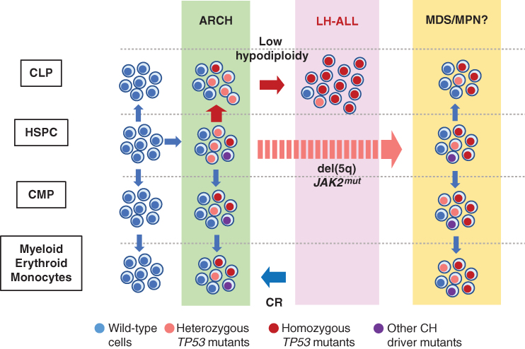 Figure 1. ARCH-derived evolution of LH-ALL. With aging those HSPCs that acquire driver mutations, including TP53 mutations, are positively selected to establish ARCH, multilineage hematopoiesis of mutant clones. Among these, TP53-mutated HSPCs give rise to common lymphoid progenitors (CLP) and B-cell precursors, in addition to common myeloid progenitors (CMP). TP53 alteration further acquires hypodiploidy to develop LH-ALL. TP53-mutated ARCH cells survive and reconstitute hematopoiesis after remission induction. In some cases, the bone marrow is reconstituted by ARCH clones after remission induction. In other cases, the reconstitution was made by MDS or MDS-related clones.