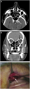Figure 9-4.