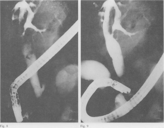 Figs 8 and 9