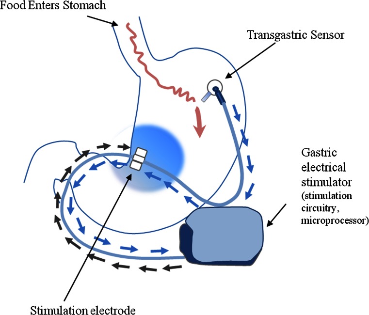 Fig. 1