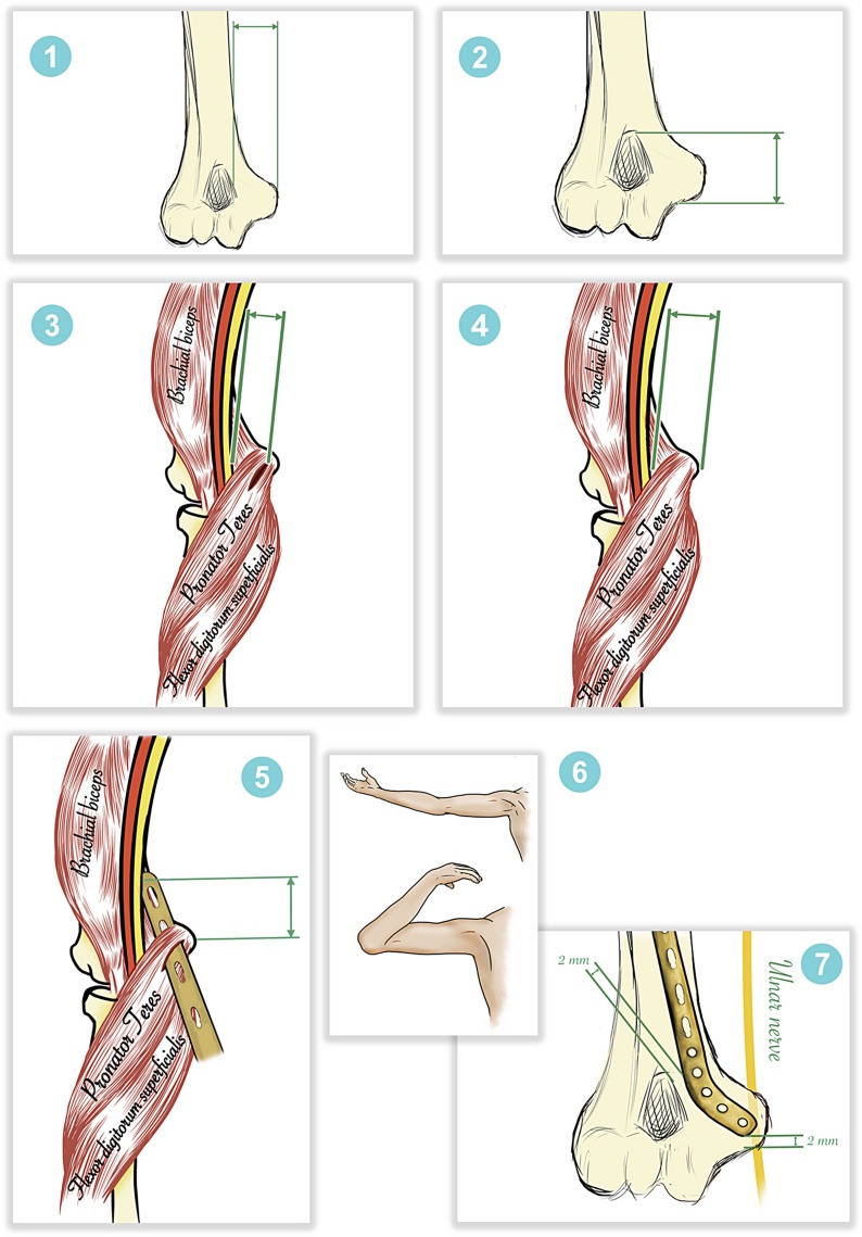 Fig. 9