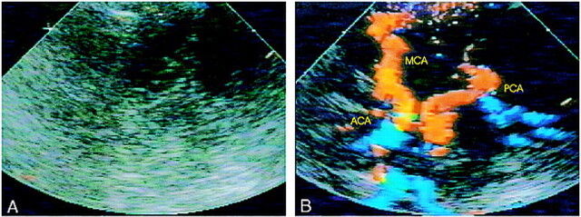 fig 1.