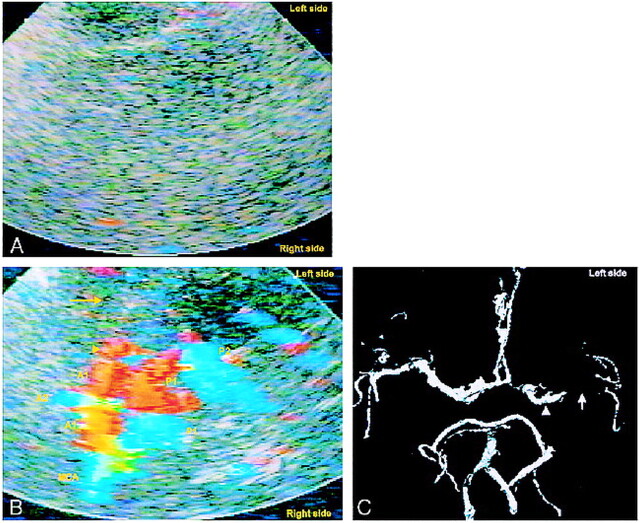 fig 3.