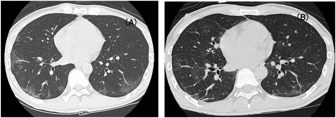 Fig. 1