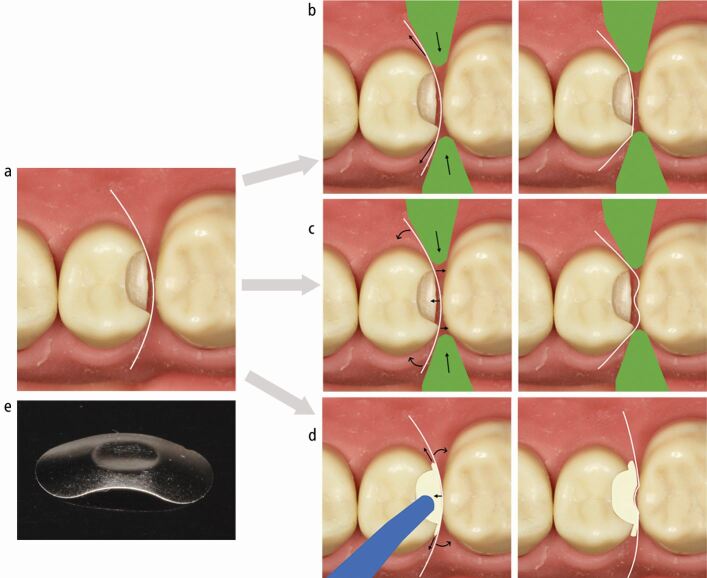 Fig. 9