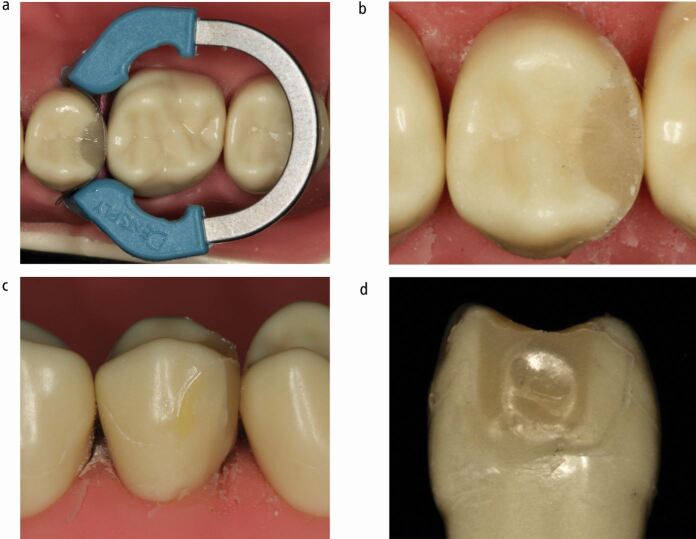 Fig. 3