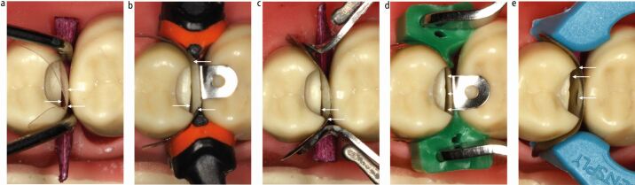 Fig. 10