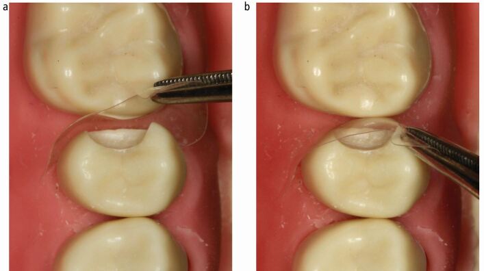 Fig. 7