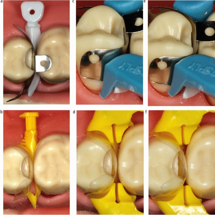 Fig. 11