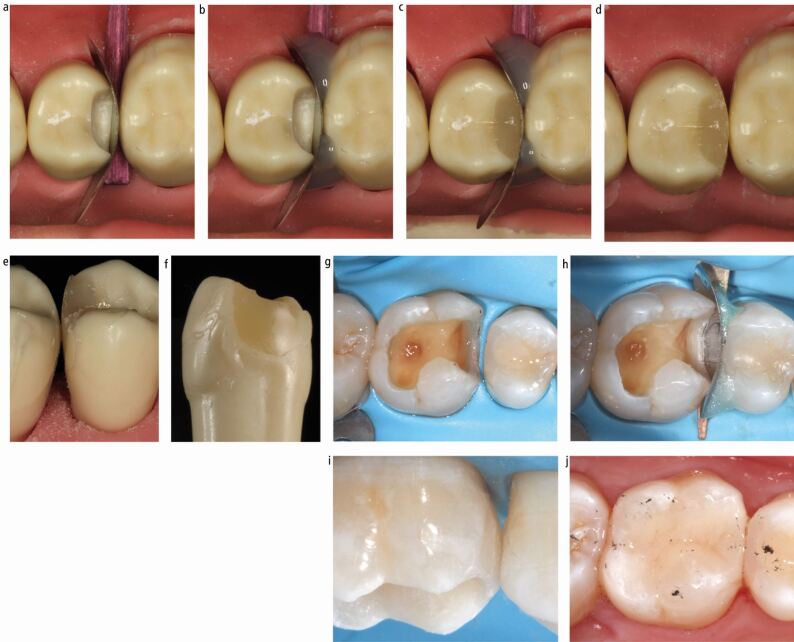 Fig. 12