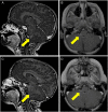 Fig. 1.