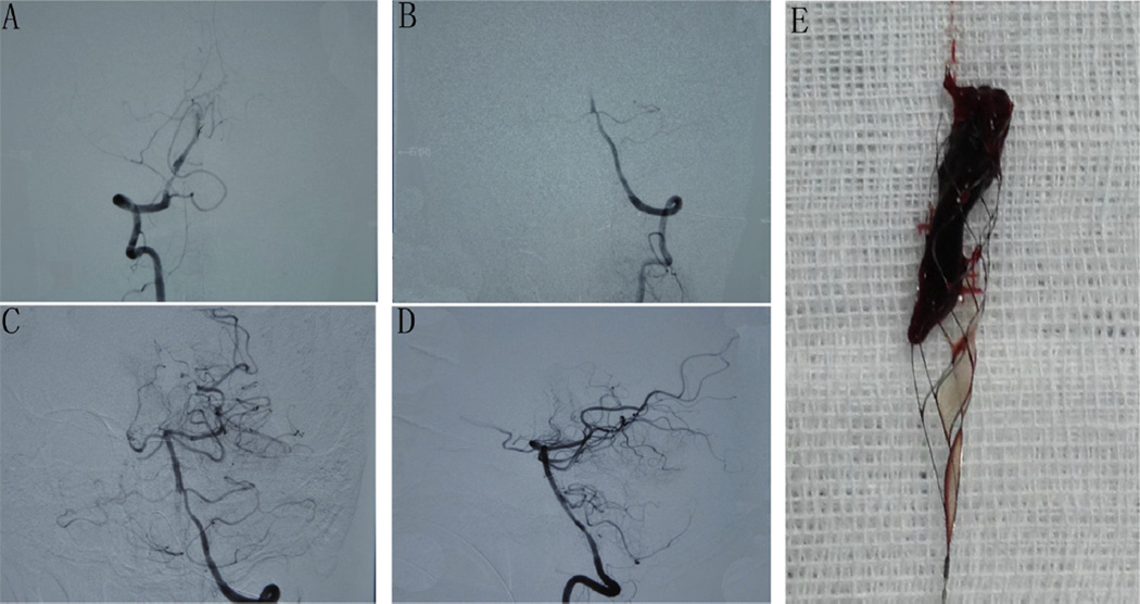 Fig. 1