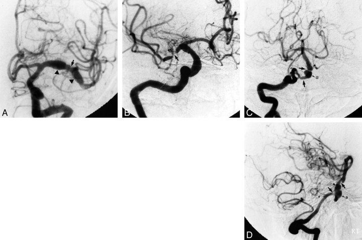 fig 2.