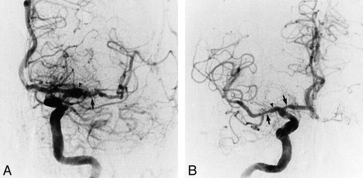 fig 3.