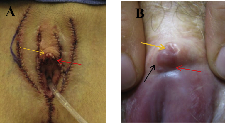 Fig. 2