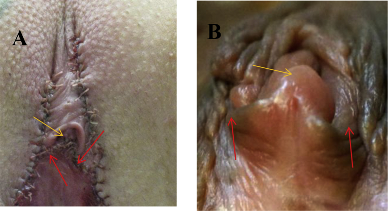 Fig. 1