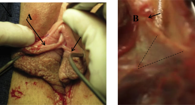 Fig. 3