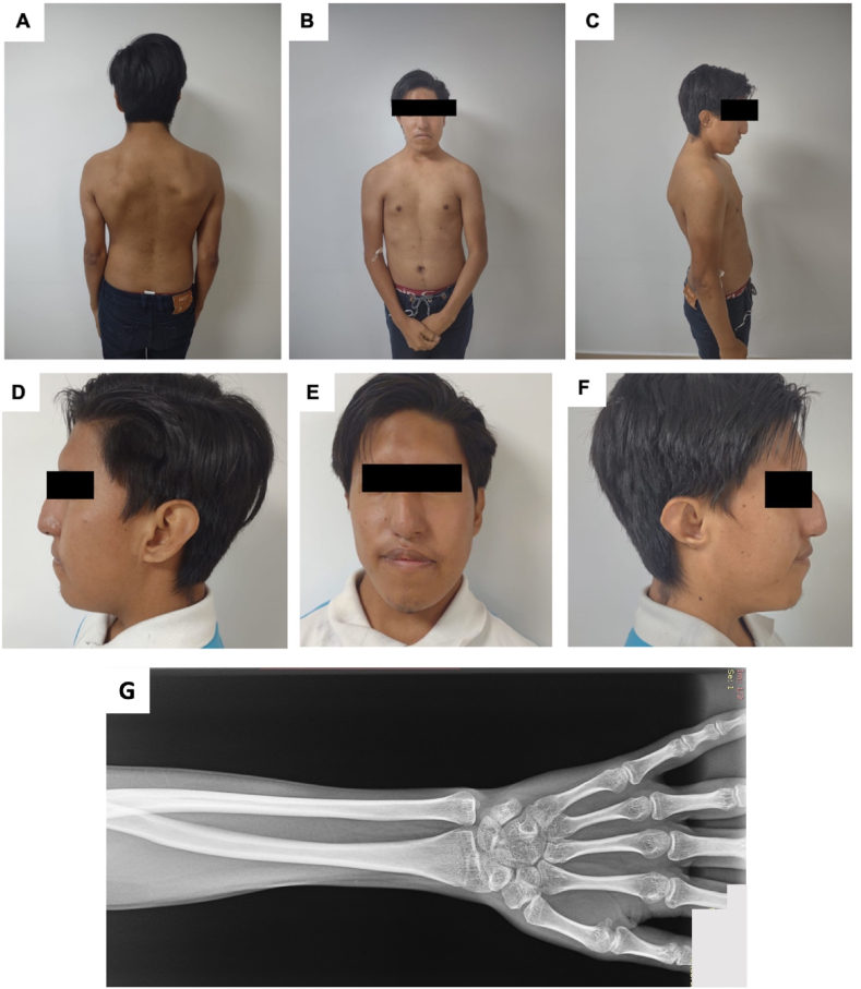 Fig. 2