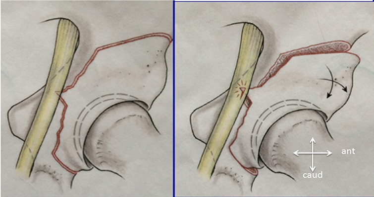 Fig. 18