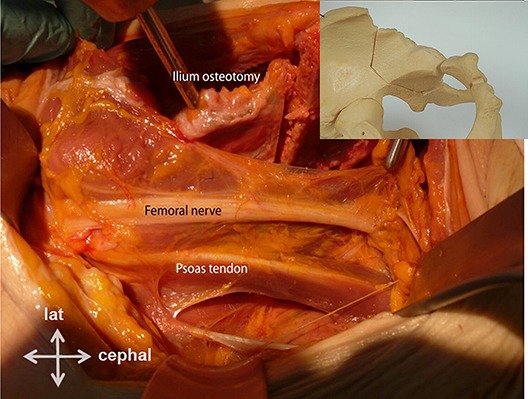 Fig. 14