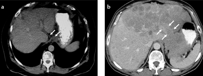 Figure 7. a, b.