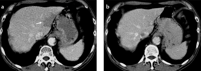 Figure 6. a, b.