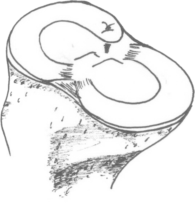 Fig 5
