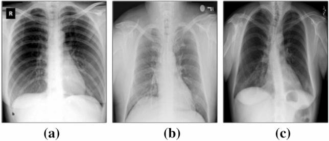 Fig. 7