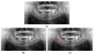 Figure 19