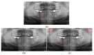 Figure 20