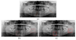 Figure 18
