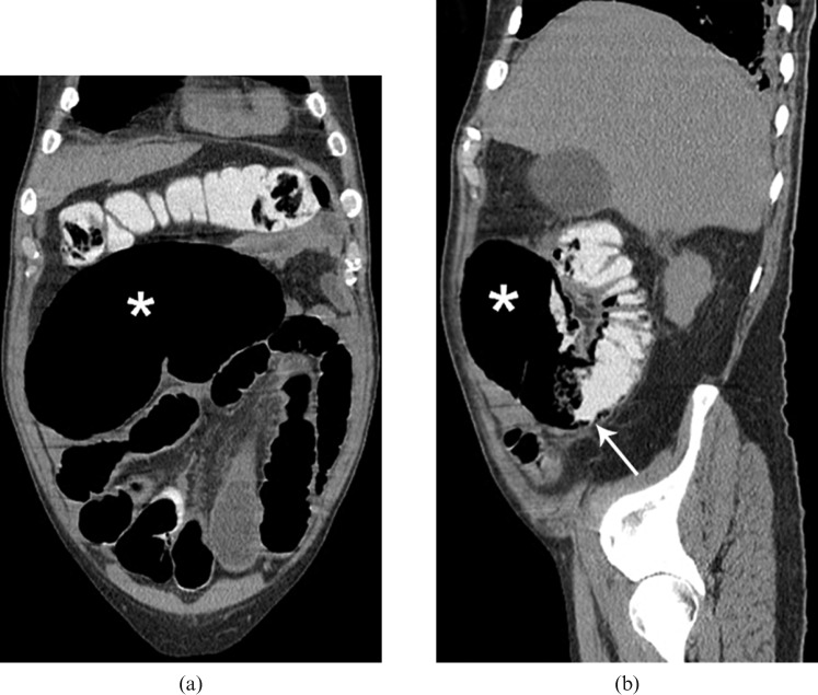 Figure 9