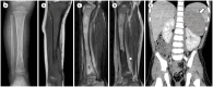 Fig. 11