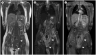 Fig. 14