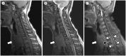 Fig. 13
