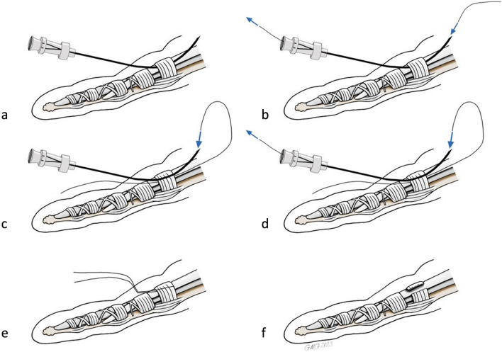 Fig. 3