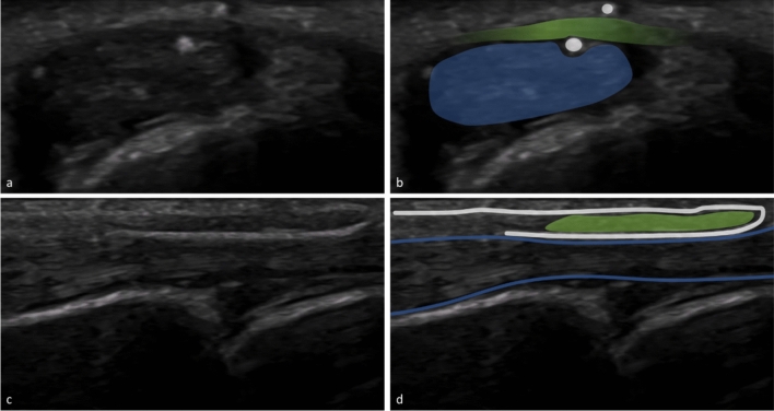 Fig. 4