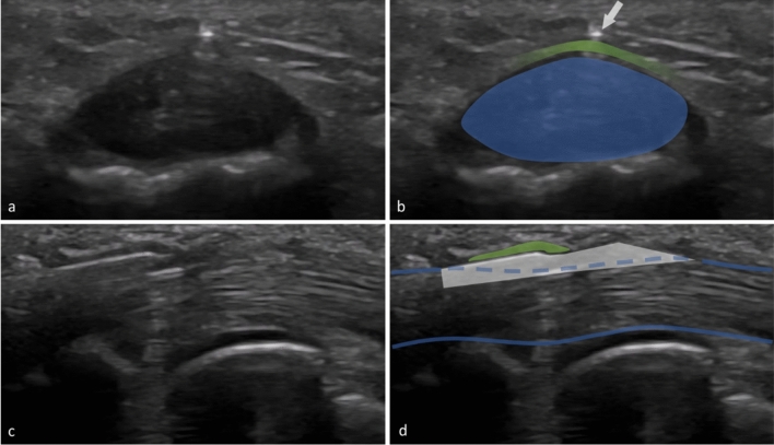 Fig. 2