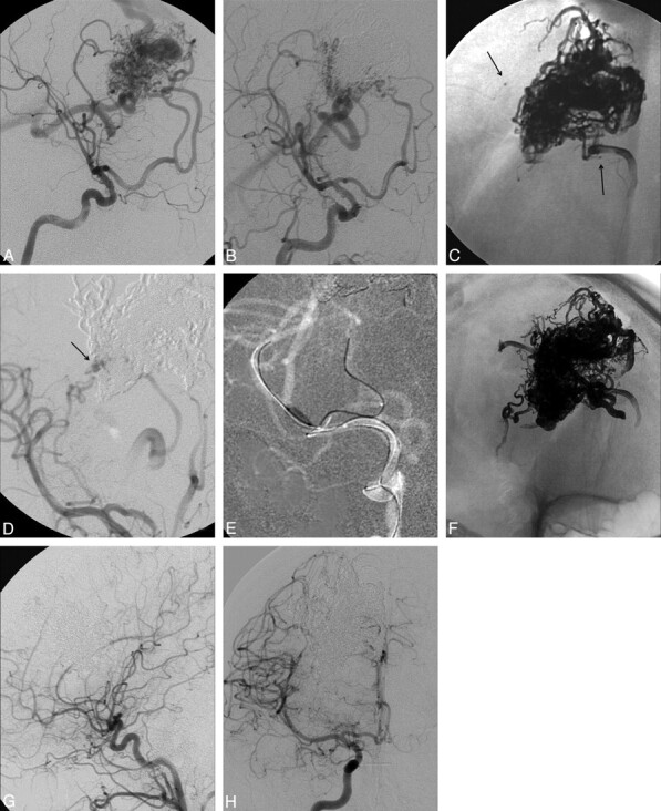 Fig 2.