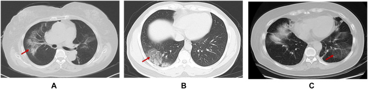 FIGURE 2